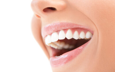 Invisalign in Houston: A Comprehensive Guide to Achieving Your Perfect Smile