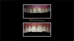 Cosmetic Dentists Houston