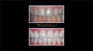 Cosmetic Dentist of Houston