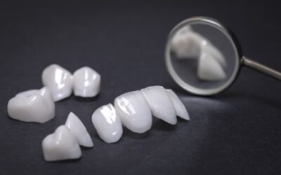 How Tooth-Colored Crowns Can Improve Smiles