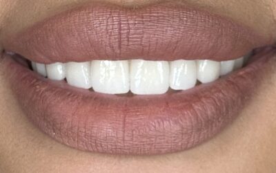 Transform Your Smile with Houston Cosmetic Dentistry